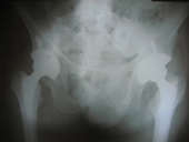 coimbatore-orthopaedic-joint-replacement-maternity-child-welfare-centre-india